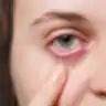 Paraudusi akis iš arti
